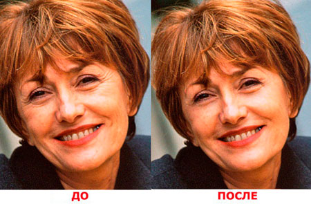 http://www.photoshop-master.ru/lessons/2007/250907/wrinkels/final000.jpg